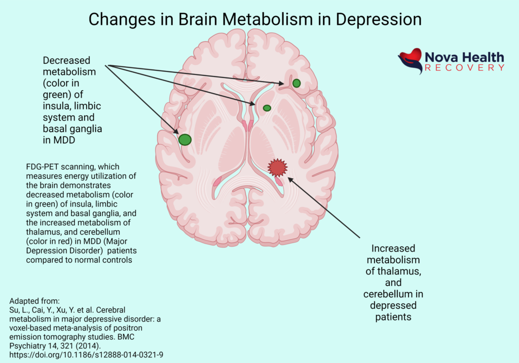 NOVA Health Recovery Ketamine Infusion Center - Alexandria, Virginia - Virginia's leading ketamine treatment provider