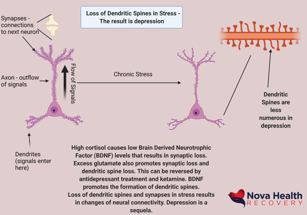NOVA Health Recovery Ketamine Infusion Center - Alexandria, Virginia - Virginia's leading ketamine treatment provider