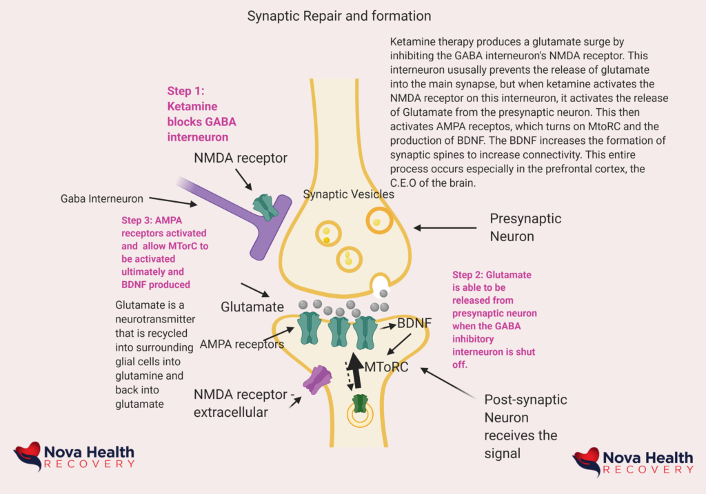 NOVA Health Recovery Ketamine Infusion Center - Alexandria, Virginia - Virginia's leading ketamine treatment provider