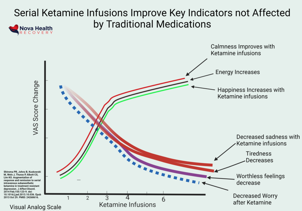 NOVA Health Recovery Ketamine Infusion Center - Alexandria, Virginia - Virginia's leading ketamine treatment provider