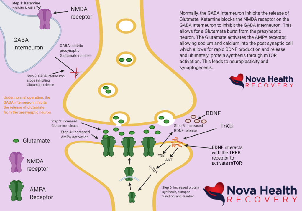 NOVA Health Recovery Ketamine Infusion Center - Alexandria, Virginia - Virginia's leading ketamine treatment provider