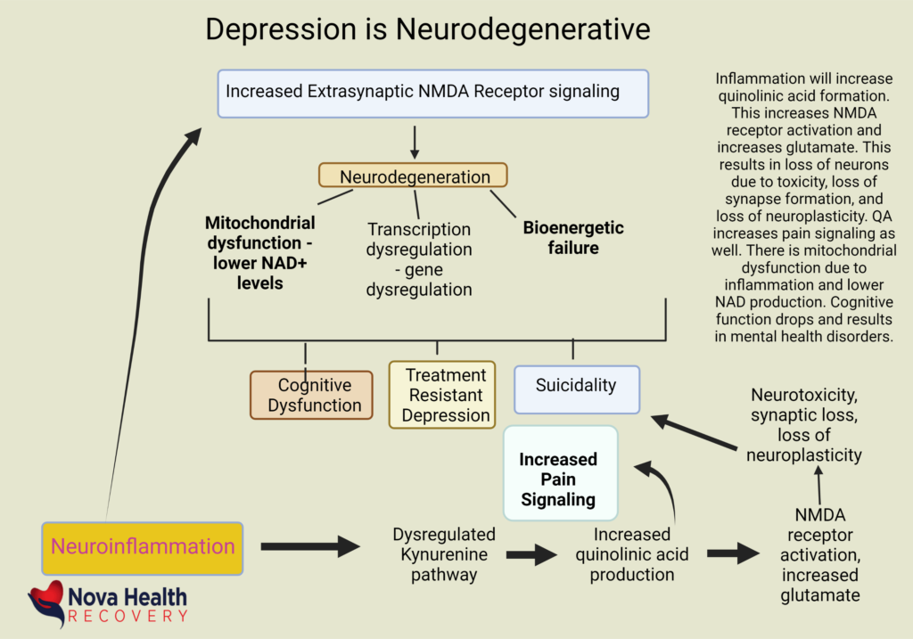NOVA Health Recovery Ketamine Infusion Center - Alexandria, Virginia Rapid depression treatment